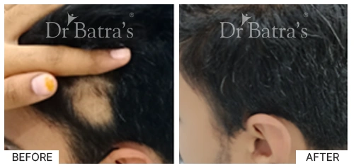 Dr Johncy cured case 2