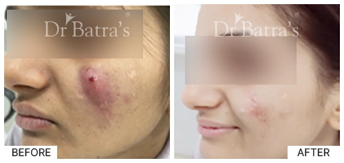 Dr Johncy cured case 3