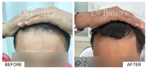 Dr Johncy cured case 4