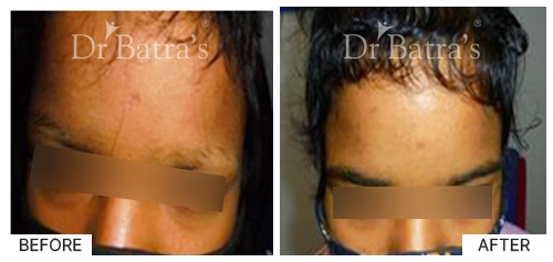 dr BHARTI ISSAR-p2
