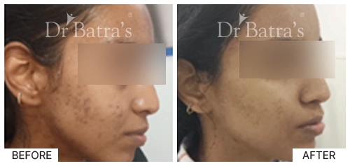 Dr. A MANJUNATH case 1
