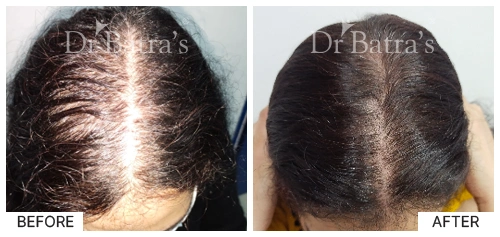 Dr Shweta Tiwari-p5