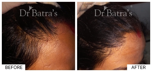 Dr SUDEEPTA INDRA-p1
