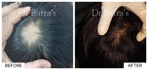 Dr SUDEEPTA INDRA-p3
