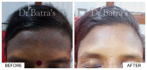 Dr SUDEEPTA INDRA-p2