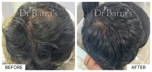 dr VIKAS JASWAL-p4