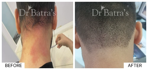 dr VIKAS JASWAL-p7