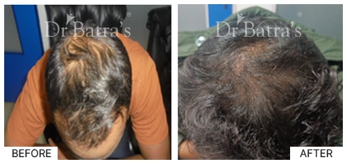 Dr PANKAJ TEWARI-p2