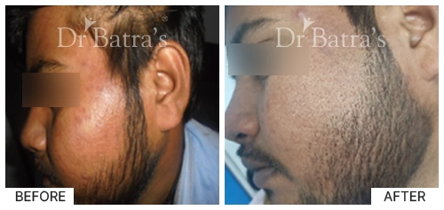 Dr PANKAJ TEWARI-p7