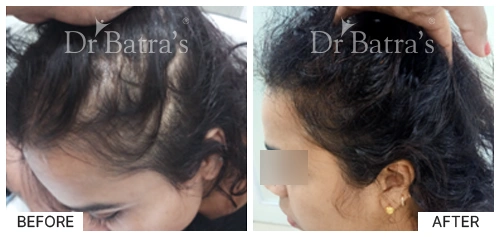 Dr RACHANA WAHANE-p1