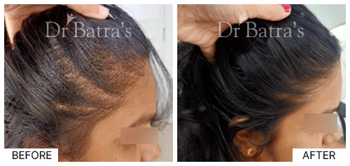 Dr RACHANA WAHANE-p4