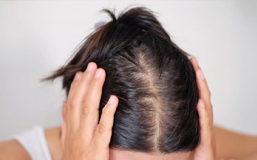 10 bad habits causing hair thinning