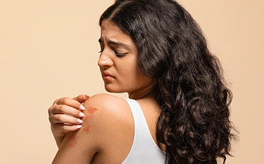 Epsom Salt for Psoriasis: Benefits & Soothing Baths