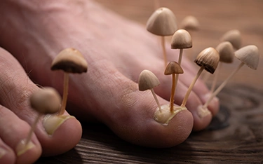 Fungal Skin, Hair, and Nail Infections: Symptoms & Treatment | Dr Batra's®