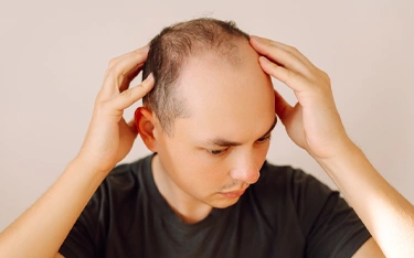 grooming-tips-bald-look-summer