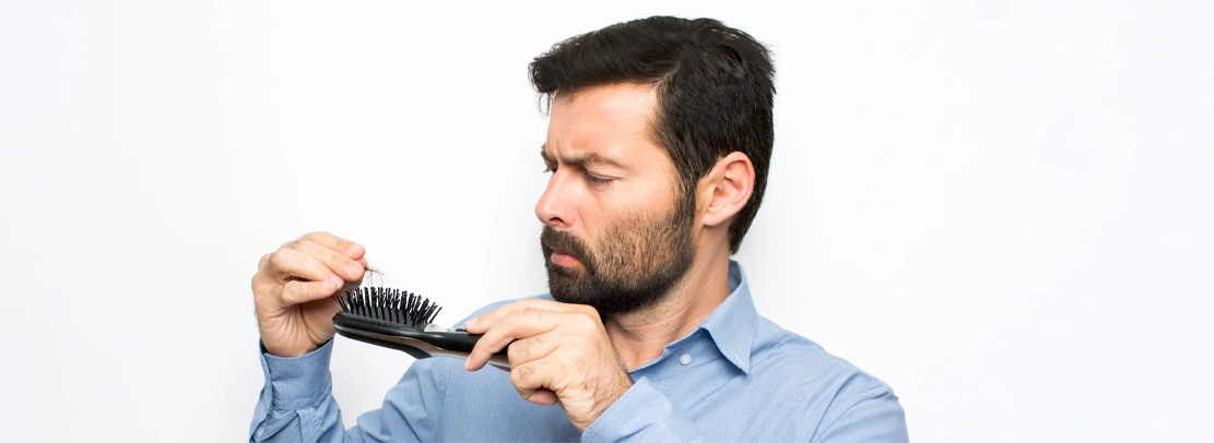 male pattern baldness