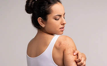 Remedy for itchy skin at night