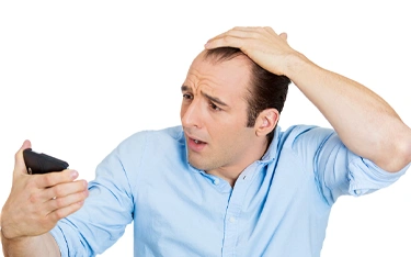 The bald truth of men losing hair in their 20s