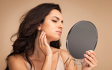 Can skin stress lead to pimples?