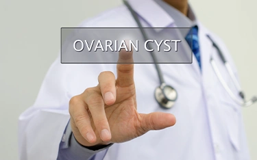 Ovary Cyst and Hair loss – What’s the link?