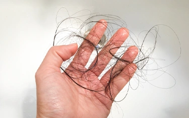 Home remedies to prevent hair fall in monsoon
