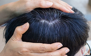 Should You Worry If Your Child Has Grey Hair?