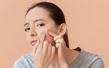 Acne Causes – What Triggers Those Recurrent Breakouts?