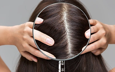 Non surgical Hair Replacement Treatment