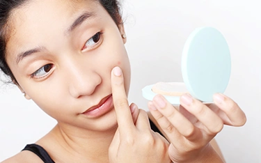 Teenage acne: when it’s time to see a doctor?