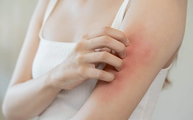 Watch Out for These Monsoon Skin Diseases