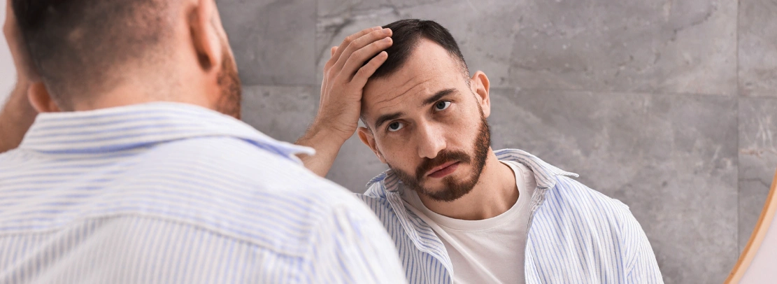 male pattern baldness