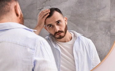 What are the types of hair loss seen in men?
