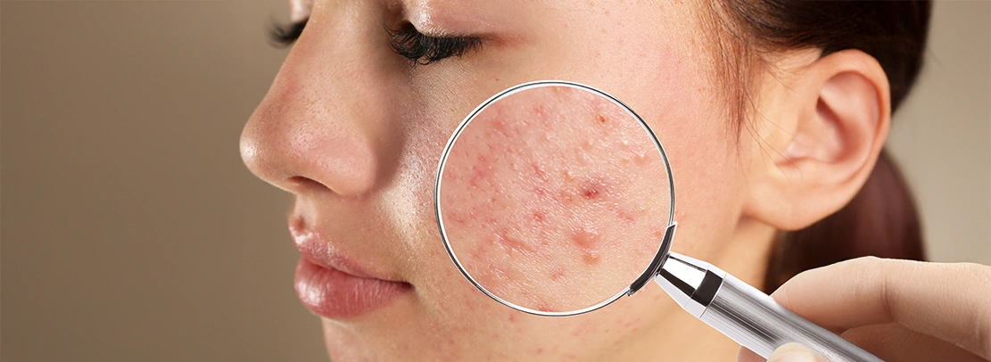 10 most common skin disorders