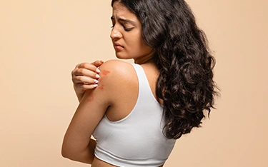 Causes of Eczema