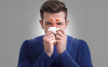What is Sinusitis, Its Types & Homeopathy Treatment