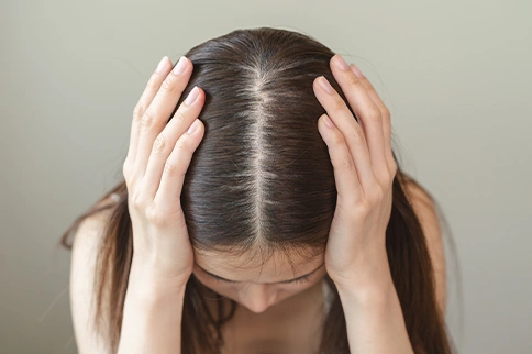image of Female Pattern Baldness-Causes: What Triggers Hair Thinning in Women?