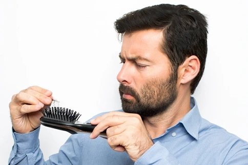 Hair Loss Causes – Understanding Why Your Hair Is Falling Out