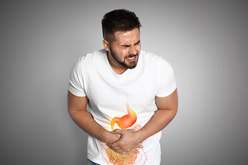 image of Homeopathic Medicines For Indigestion