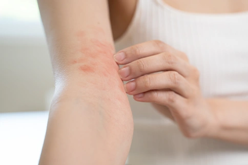 Get rid of itchy skin