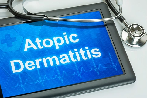 Treat atopic dermatitis