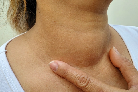 Swelling my neck