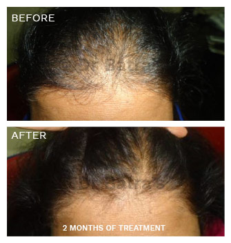 Dr Batra S Homeopathy Get Homeopathic Medicine And Treatment