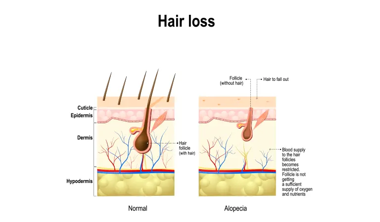 10 Most effective hair loss treatments