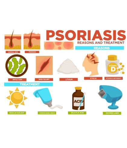 Vitamin D: Why is it so good for psoriasis?