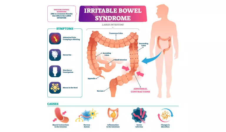 Efficacy of Homeopathic Remedies for Irritable Bowel Syndrome (IBS)