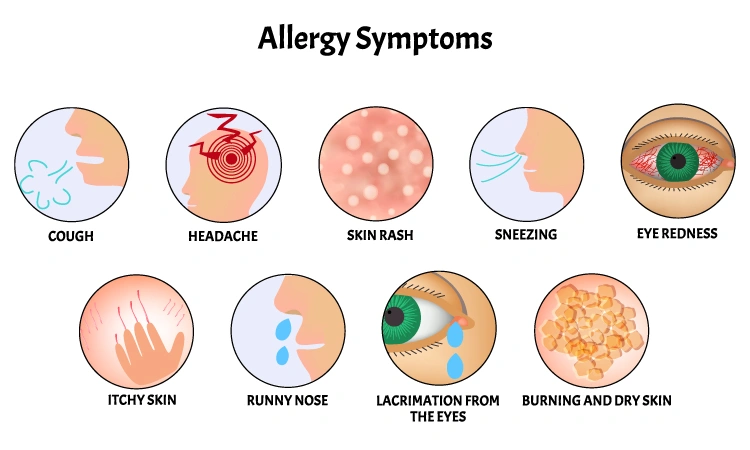 Symptoms of allergies