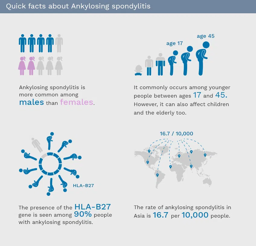 Ankylosing-spondylitis