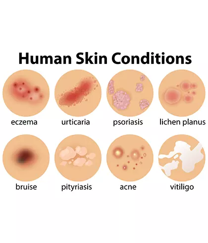 Can homeopathy help with skin diseases