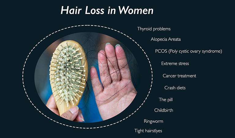 Crash dieting and hair fall in women