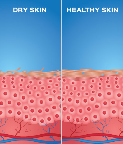 What causes dehydrated skin & how to treat it?
